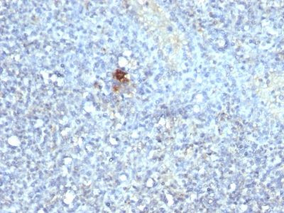 TRAcP Monoclonal Mouse Antibody (ACP5/1070)