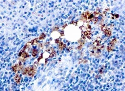 TRAcP Recombinant Monoclonal Mouse Antibody (rACP5/1070)