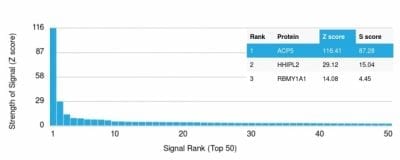 TRAcP Recombinant Monoclonal Mouse Antibody (rACP5/1070)