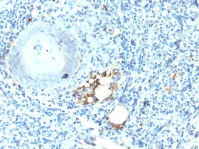 TRAcP Recombinant Monoclonal Rabbit Antibody (ACP5/2336R)