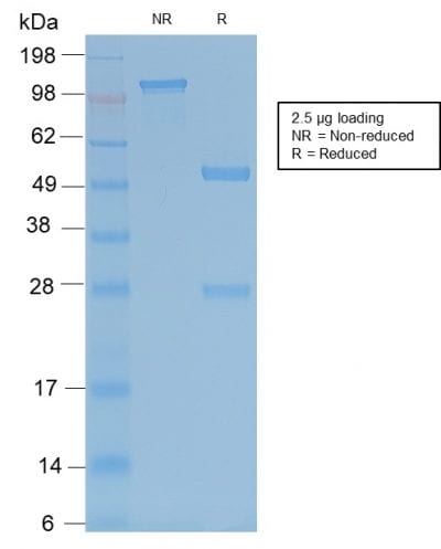 TRAcP Recombinant Monoclonal Rabbit Antibody (ACP5/2336R)