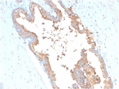 Transferrin Monoclonal Mouse Antibody (TF/3001)