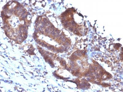 Transgelin / SM22-Alpha Monoclonal Mouse Antibody (TAGLN/247)