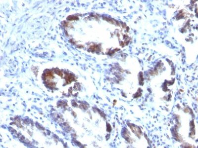 Transgelin / SM22-Alpha Monoclonal Mouse Antibody (TAGLN/247)