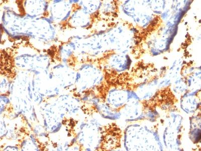 Transglutaminase-II Monoclonal Mouse Antibody (TGM2/419)