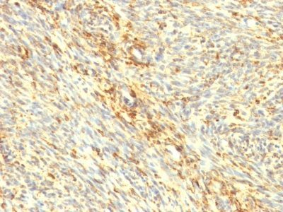 Transglutaminase-II Monoclonal Mouse Antibody (TGM2/419)