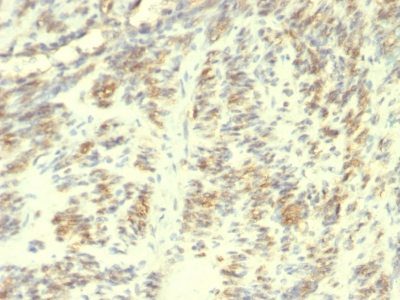Transglutaminase-II Monoclonal Mouse Antibody (TGM2/419)