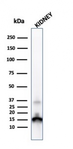 Transthyretin Monoclonal Mouse Antibody (CPTC-TTR-1)