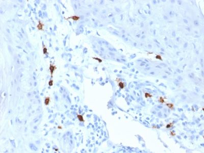 Tryptase Monoclonal Mouse Antibody (TPSAB1/1963)