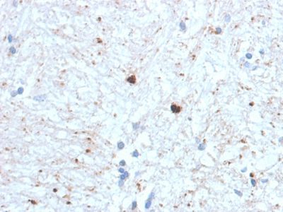 Ubiquitin Monoclonal Mouse Antibody (UBB/1748)