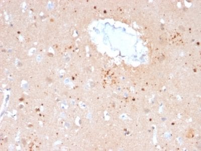 Ubiquitin Monoclonal Mouse Antibody (UBB/2122)