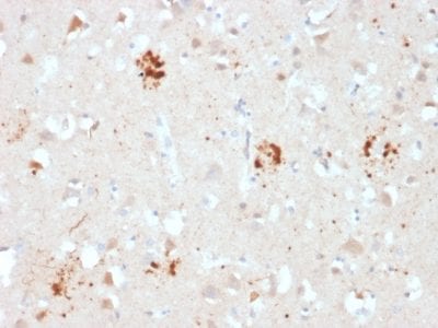 Ubiquitin Monoclonal Mouse Antibody (UBB/2122)