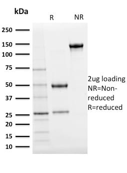 Ubiquitin Monoclonal Mouse Antibody (UBB/2122)