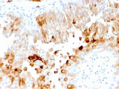 Uroplakin 1A Monoclonal Mouse Antibody (UPK1A/2921)