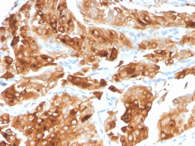 Uroplakin 1A Monoclonal Mouse Antibody (UPK1A/2922)