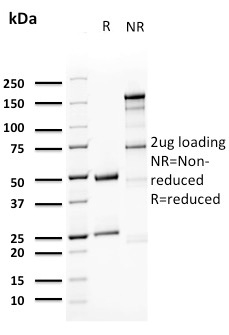 Uroplakin 1A Monoclonal Mouse Antibody (UPK1A/2923)