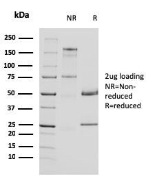 Uroplakin 1A Monoclonal Mouse Antibody (UPK1A/2924)