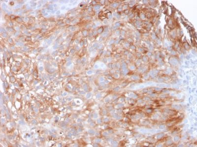 Uroplakin 1A Monoclonal Mouse Antibody (UPK1A/2925)