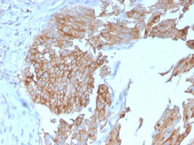 Uroplakin 1B Monoclonal Mouse Antibody (UPK1B/3102)