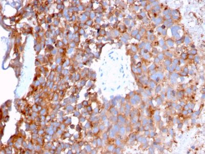 Uroplakin 1B Monoclonal Mouse Antibody (UPK1B/3273)