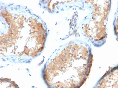 Vinculin Monoclonal Mouse Antibody (VCL/2573)