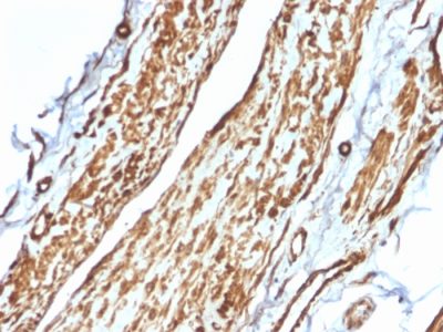 Vinculin Monoclonal Mouse Antibody (VCL/2575)