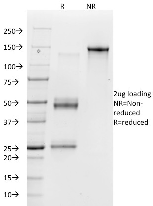 Vitronectin Receptor / CD51 / CD61 Monoclonal Mouse Antibody (23C6)
