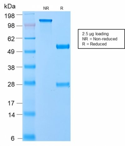 VLDL Receptor Recombinant Monoclonal Rabbit Antibody (VLDLR/2896R)