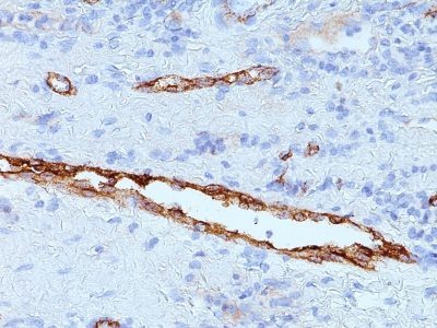 von Willebrand Factor / vWF Monoclonal Mouse Antibody (3E2D10 + VWF635)