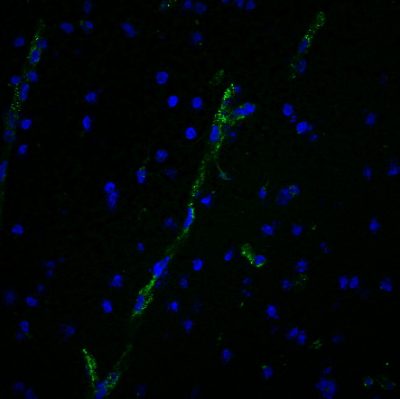 von Willebrand Factor / vWF Monoclonal Mouse Antibody (3E2D10)