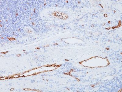von Willebrand Factor / vWF Monoclonal Mouse Antibody (3E2D10)