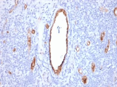 von Willebrand Factor / vWF Monoclonal Mouse Antibody (VWF/2480)