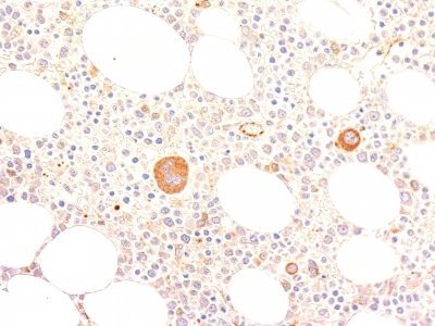 von Willebrand Factor / vWF Monoclonal Mouse Antibody (VWF635)