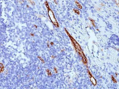 von Willebrand Factor / vWF Monoclonal Mouse Antibody (VWF635)