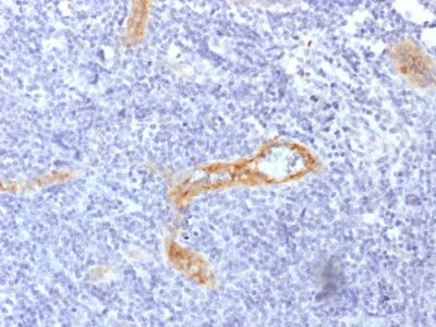von Willebrand Factor / vWF Recombinant Monoclonal Mouse Antibody (rVWF/1465)
