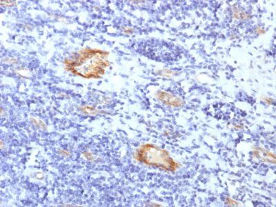 von Willebrand Factor / vWF Recombinant Monoclonal Rabbit Antibody (VWF/1859R)