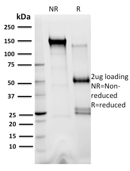 XRCC3 Monoclonal Mouse Antibody (10F1/6)