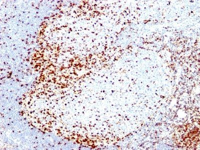 ZAP70 Monoclonal Mouse Antibody (2F3.2)