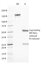 ZAP70 Monoclonal Mouse Antibody (ZAP70/2046)