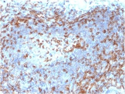 ZAP70 Monoclonal Mouse Antibody (ZAP70/2046)