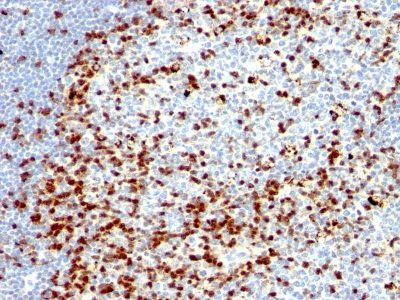 ZAP70 Monoclonal Mouse Antibody (ZAP70/528 + 2F3.2)