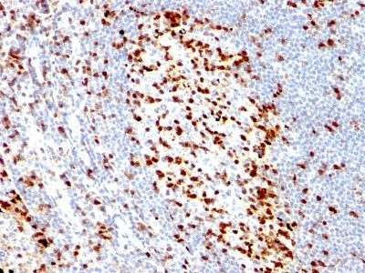 ZAP70 Monoclonal Mouse Antibody (ZAP70/528)
