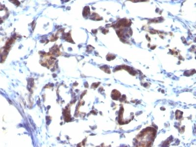 ZFYVE28 Monoclonal Mouse Antibody (LST2/2426)