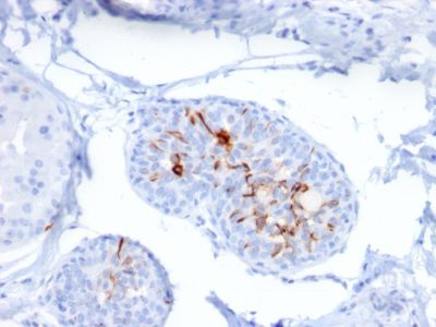 ZNF690 / ZSCAN29 Monoclonal Mouse Antibody (ZSCAN29/2610)