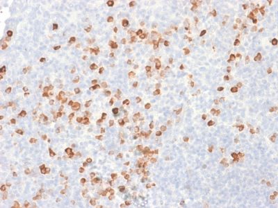 Human IgG Recombinant Monoclonal Mouse Antibody (rIG266)