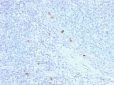 Human IgG4 Recombinant Monoclonal Mouse Antibody (rIGHG4/1345)