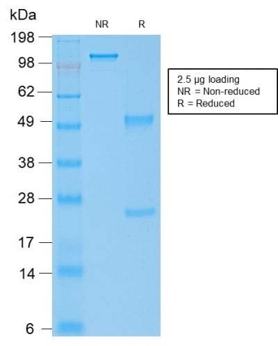 Human IgG4 Recombinant Monoclonal Mouse Antibody (rIGHG4/1345)