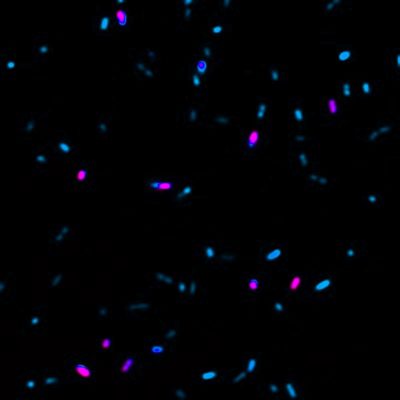 Live-or-Dye™ Fixable Viability Staining Kits