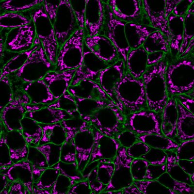 CellBrite® Steady Membrane Staining Kits