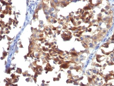 CD63 Monoclonal Mouse Antibody (LAMP3/968)